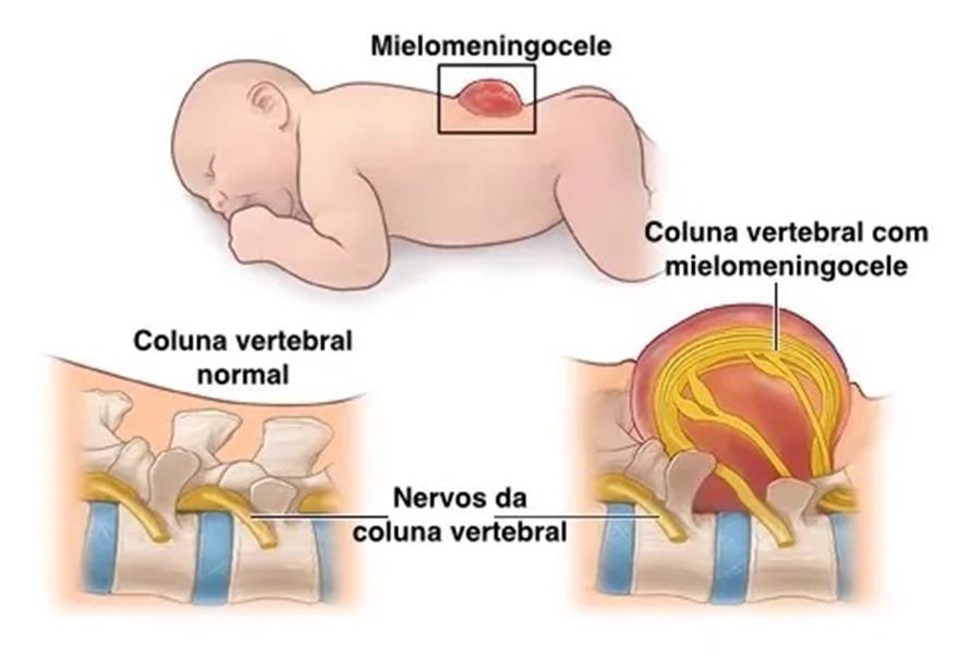 Contaminação do pai, danos à filha
